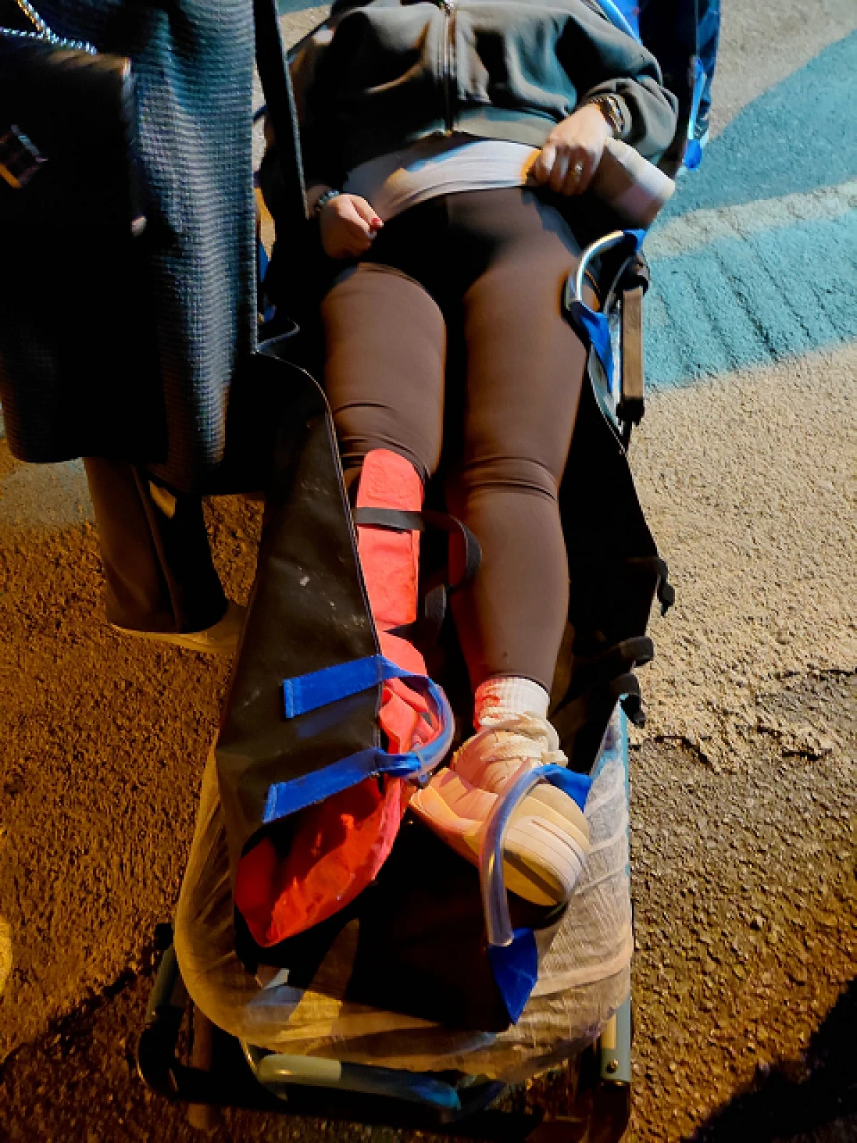 MEMLEKETİNE GELDİ AYAĞI KIRILDI